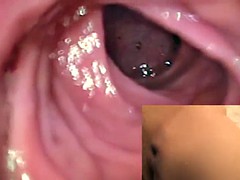 Anal, Holandés