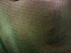 Zichtbare schaamlippen